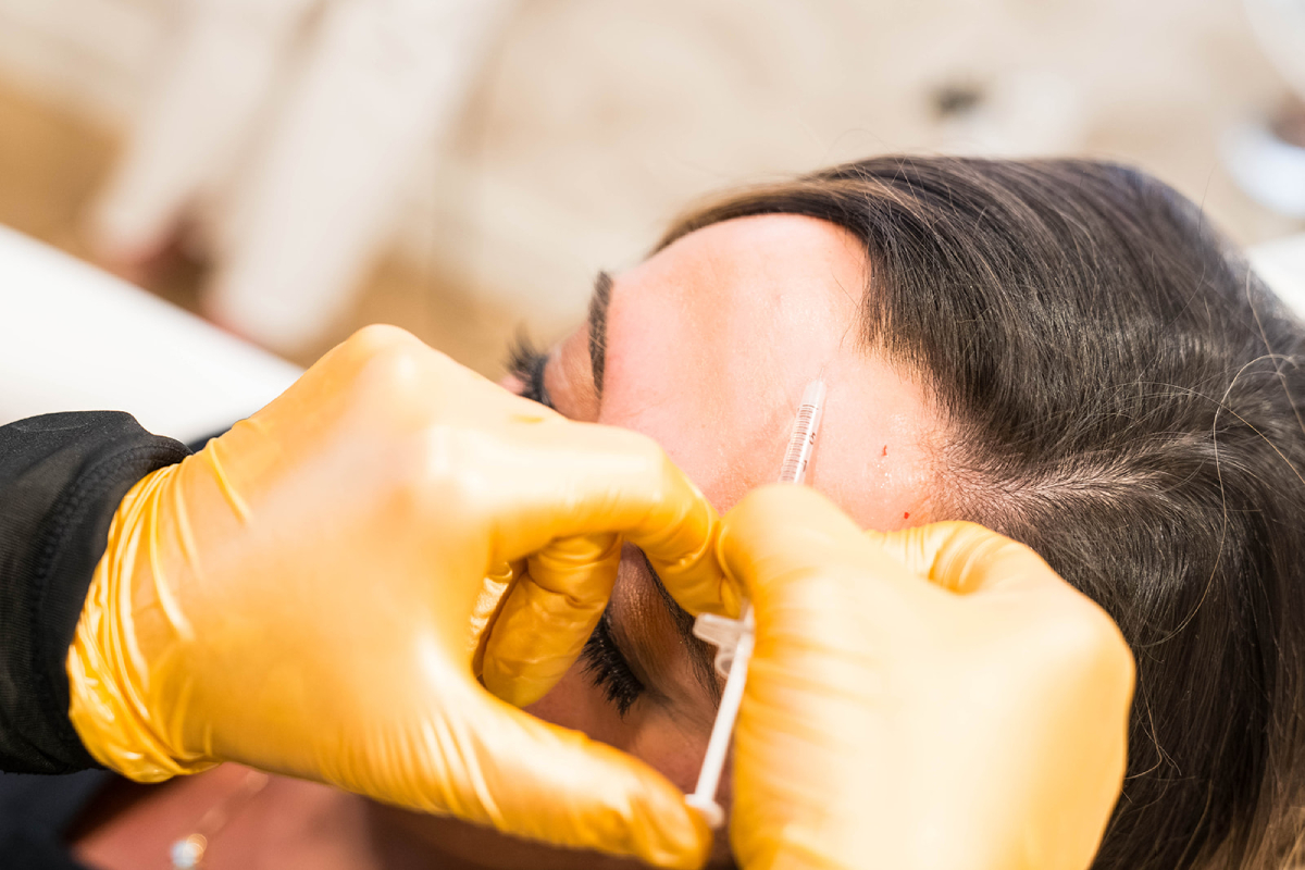 Dermal Filler